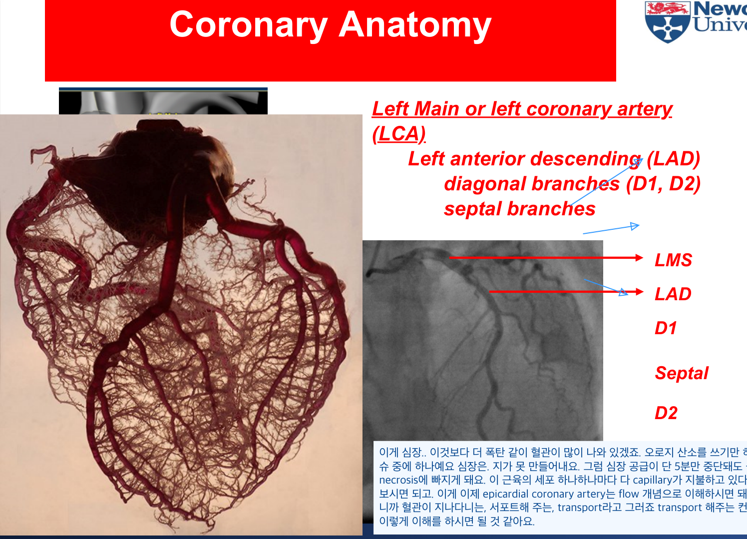 관상동맥 분지 상세 — LAD diagonal·septal branch.