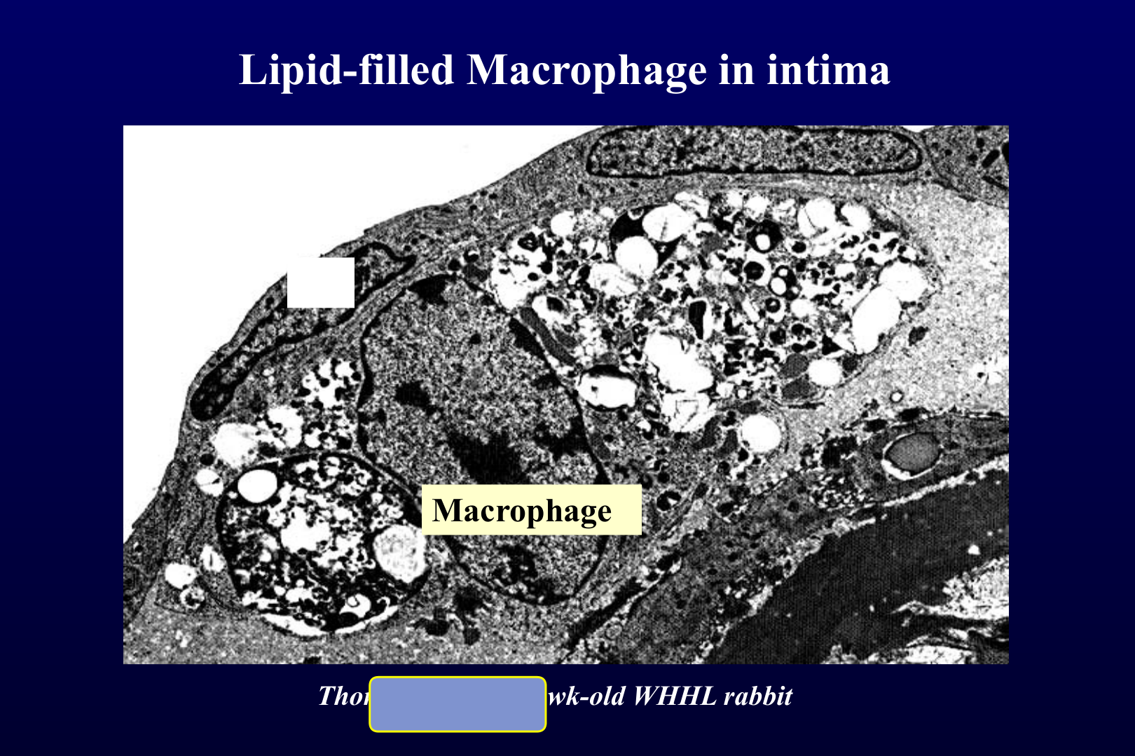 Intima 내 지질로 채워진 대식세포(foam cell) — WHHL 토끼(전자현미경).