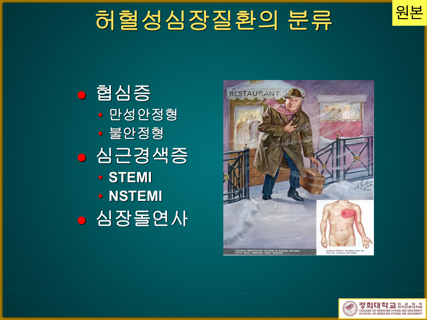전형적 협심증 삽화 — 유발인자(heavy meal·exertion·cold·smoking)와 통증 방사 분포