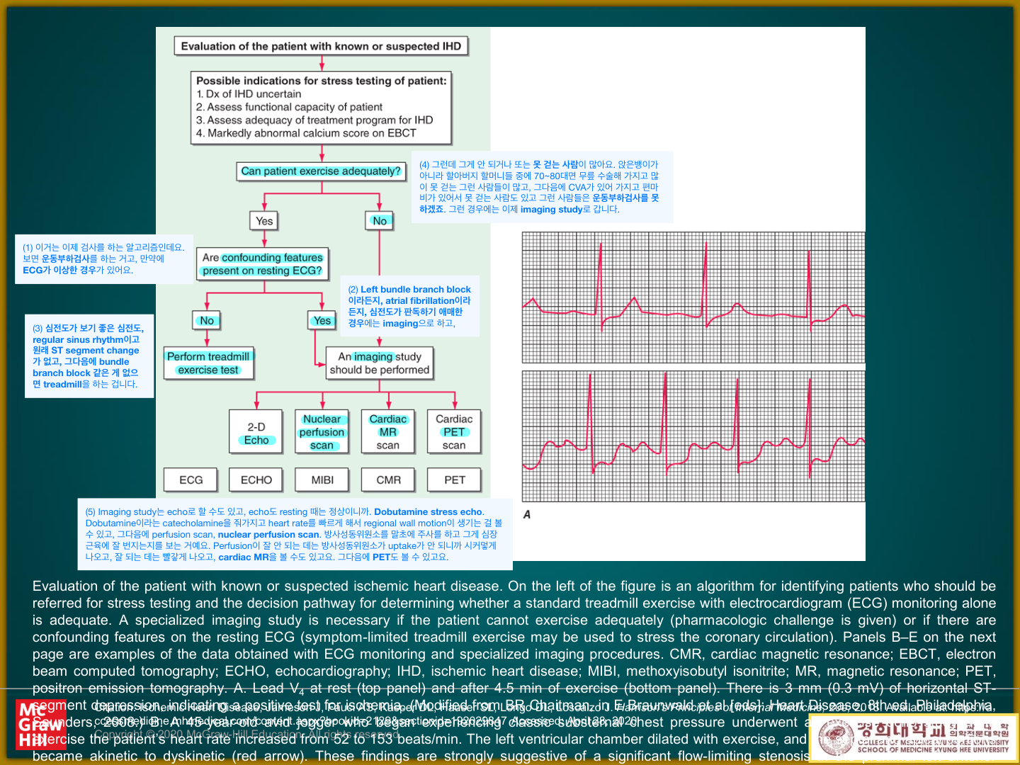 Harrison — 의심 IHD 환자의 stress testing 결정 알고리즘(treadmill vs imaging)