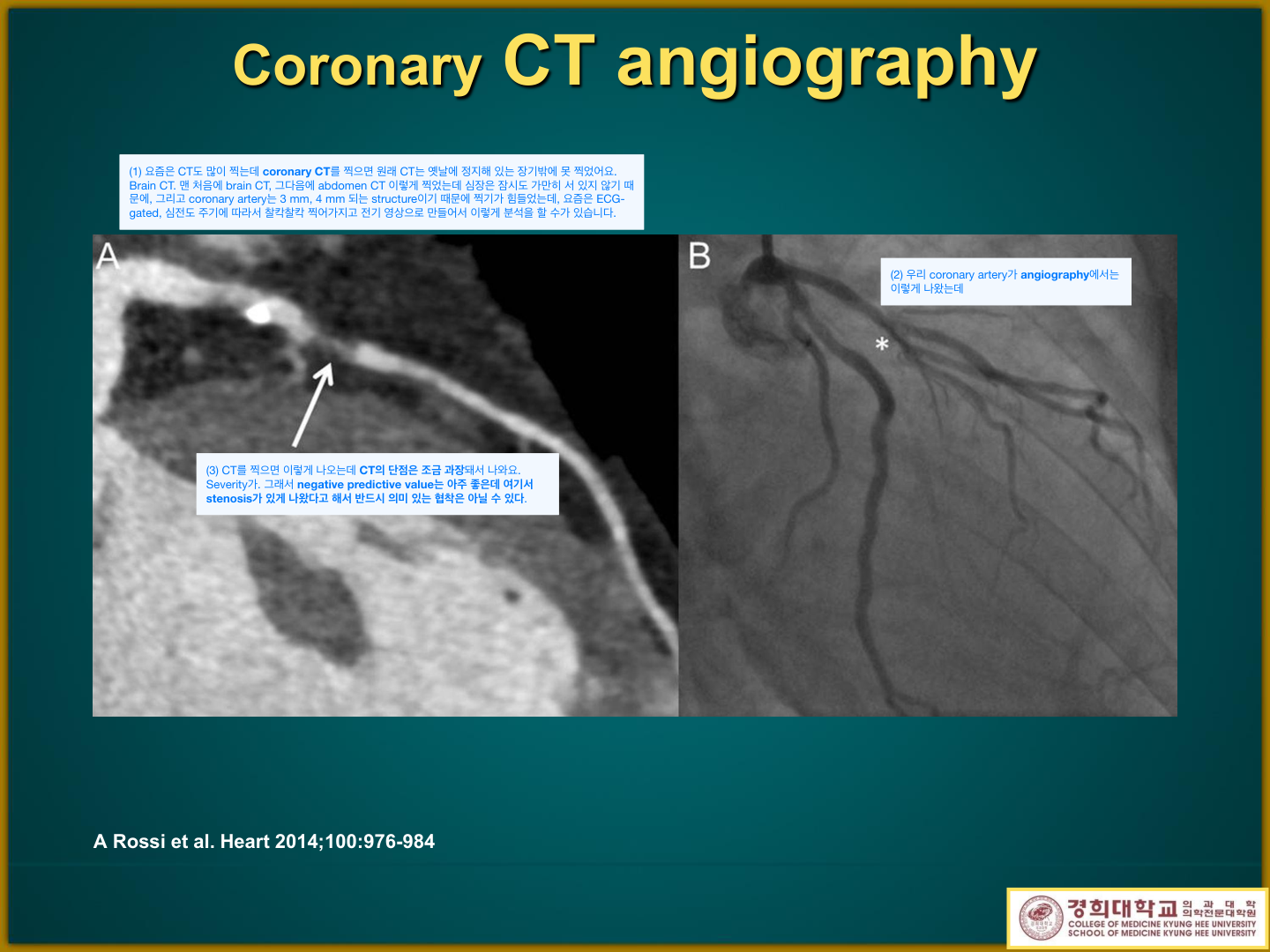 Coronary CT angiography vs invasive angiography 비교 (Rossi, Heart 2014)