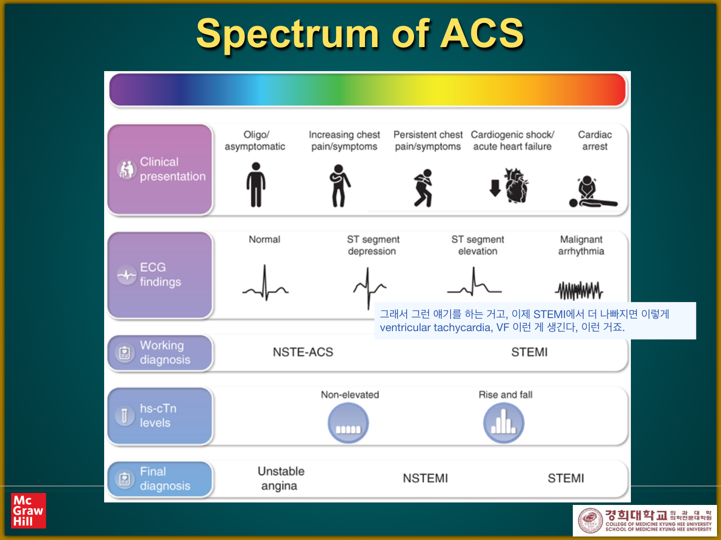 Spectrum of ACS — 임상양상·ECG·troponin에 따른 UA/NSTEMI/STEMI 분류표