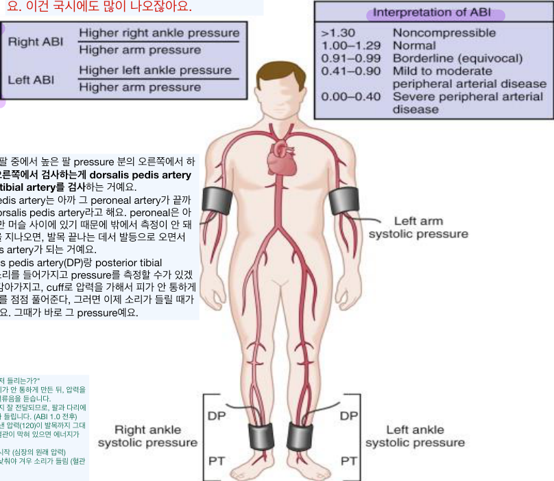 ABI 측정 부위(DP·PTA·brachial)와 하지 동맥 해부.