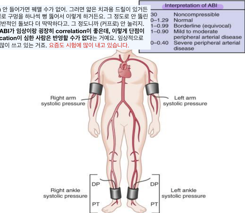 ABI 계산 예시와 하지동맥 분포(DM/ESRD 석회화 예외).