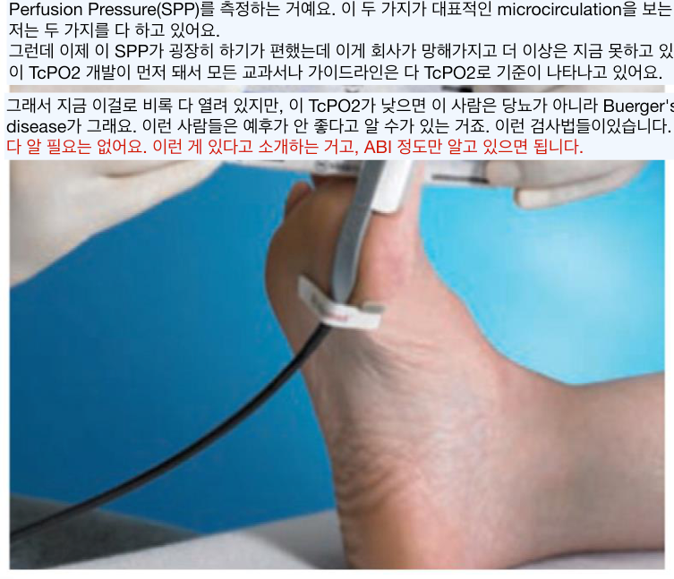 TcPO2와 laser doppler / skin perfusion pressure 측정.