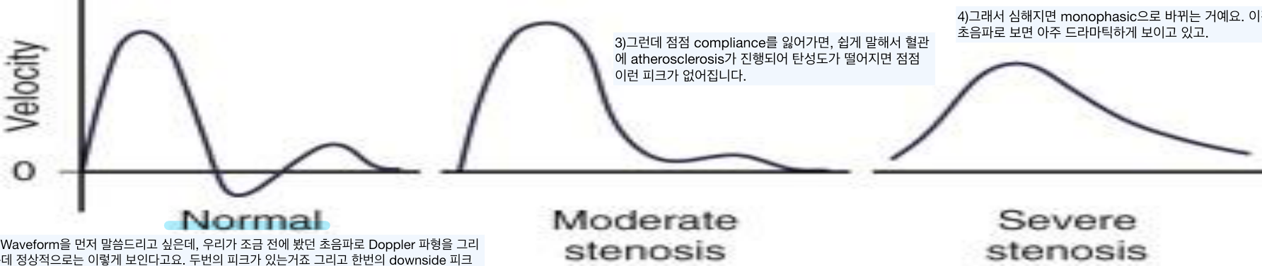 동맥 doppler waveform: triphasic→monophasic 변화(정상·중등도·중증 협착).