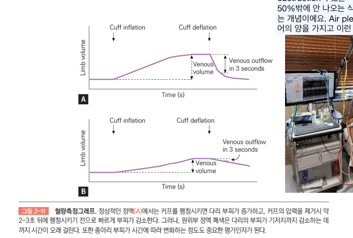 공기압혈량측정기(APG)와 광혈량측정기(PPG) 정맥검사.
