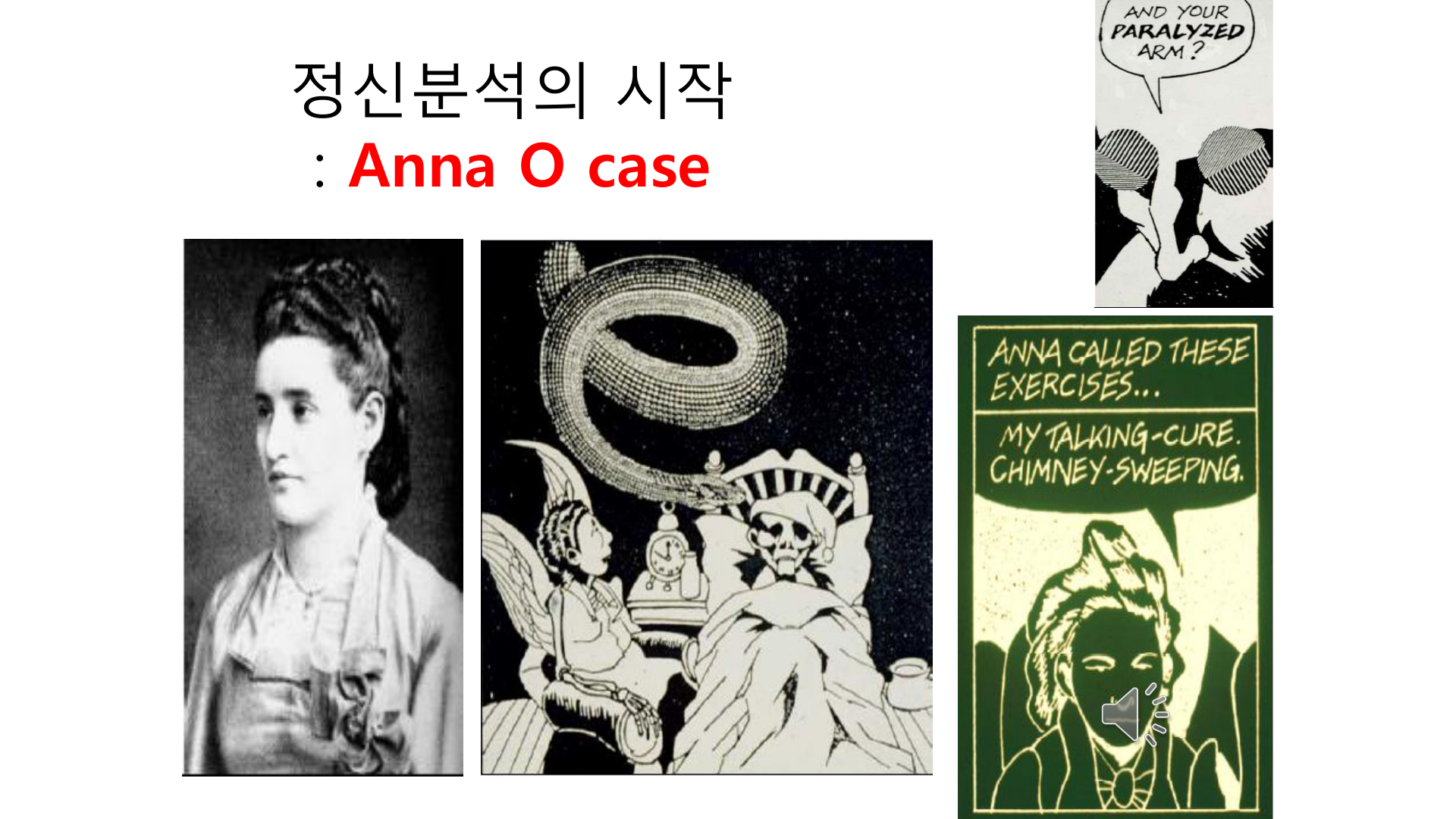 Anna O(좌)와 당시 히스테리·전환증상(마비된 팔, talking cure)을 묘사한 삽화.