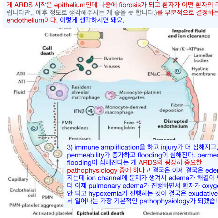 Exudative phase 폐포 손상 모식도 (Harrison)
